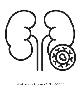 Prostate & Kidney Cancer Treatment in Pondicherry - King's Cancer Center